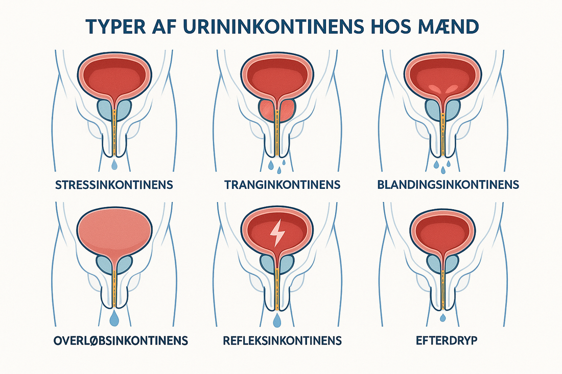 Urininkontinens hos mænd forklaring og typer